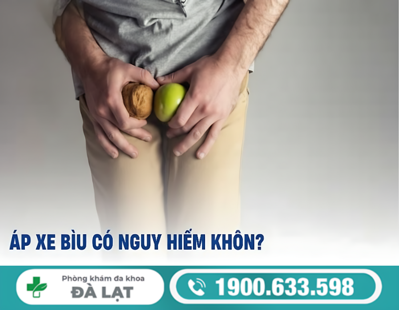 Hình ảnh minh họa